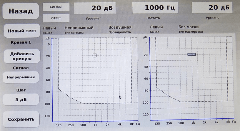 Тест Тон в шуме Тест Тон в шуме